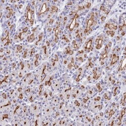 PIGU Antibody, Novus Biologicals 25 &mu;L, Unlabeled:Antibodies, Polyclonal